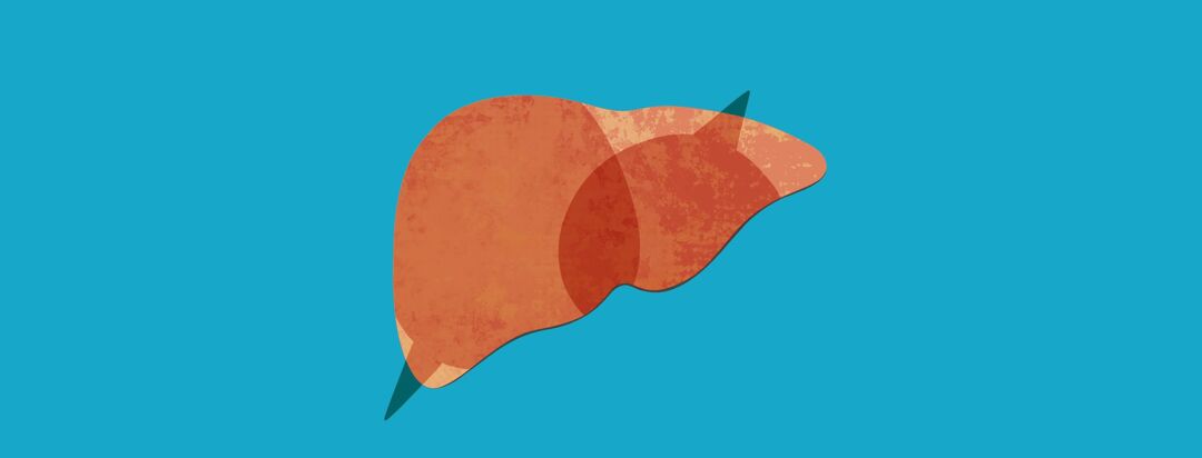 The Confident Patient: NASH Progression image